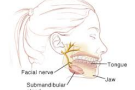 submandibular gland ecision